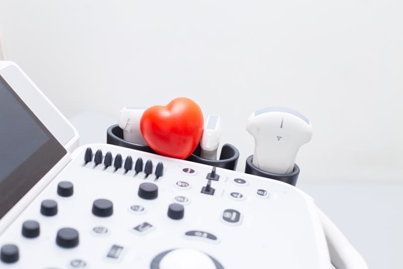 Ecocardiograma de estrés con dobutamina en Miguel Hidalgo, CDMX